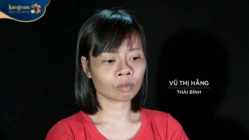 Sau 2 lần phẩu thuật hỏng, Vũ Thị Hằng đã không còn niềm tin vào thẩm mỹ