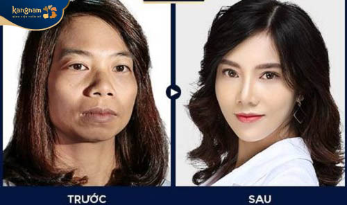 Cô giáo Vũ Thị Hoa với ngoại hình mới