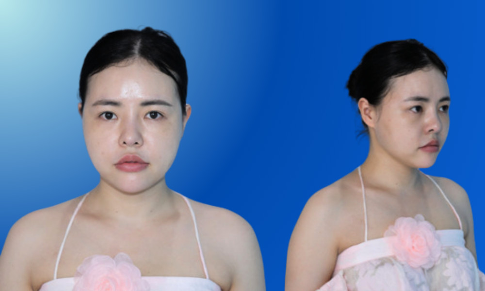 Hot streamer Hà Naga gặp tình trạng sụp mí, da chùng, mí lót