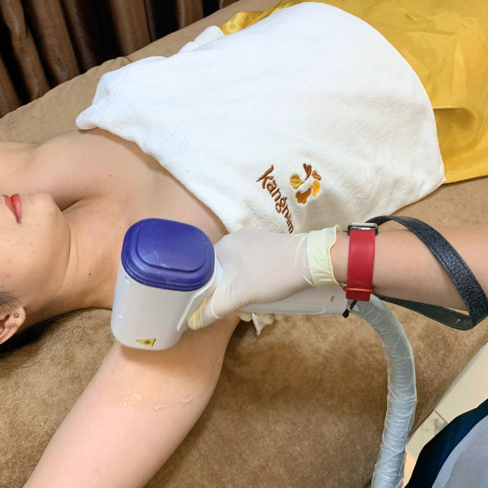 Tại sao nên đi triệt lông? Công nghệ triệt lông nổi bật tại Kangnam