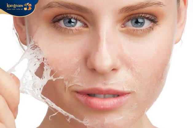 Không nên tự bóc da bong tróc, có thể khiến da tổn thương