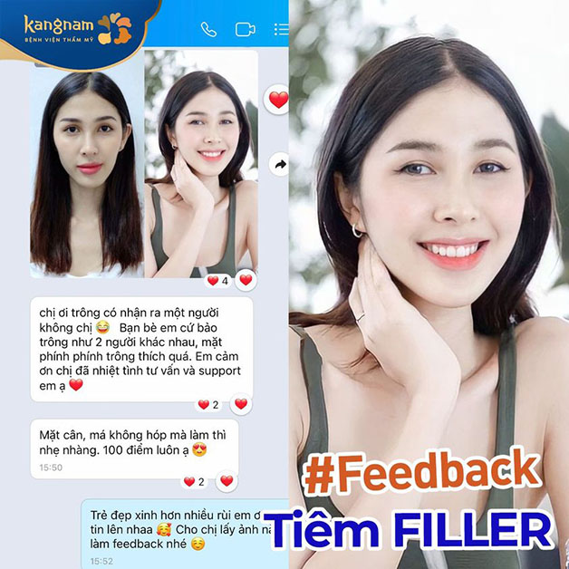 Khách hàng hài lòng và hạnh phúc sau khi chỉnh sửa các đường nét hoàn hảo tại Kangnam mà không cần phẫu thuật