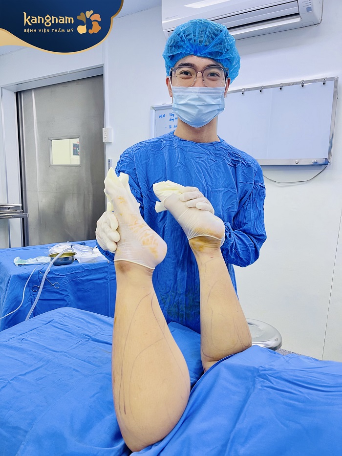 Bắp chân thon gọn sau khi giảm mỡ