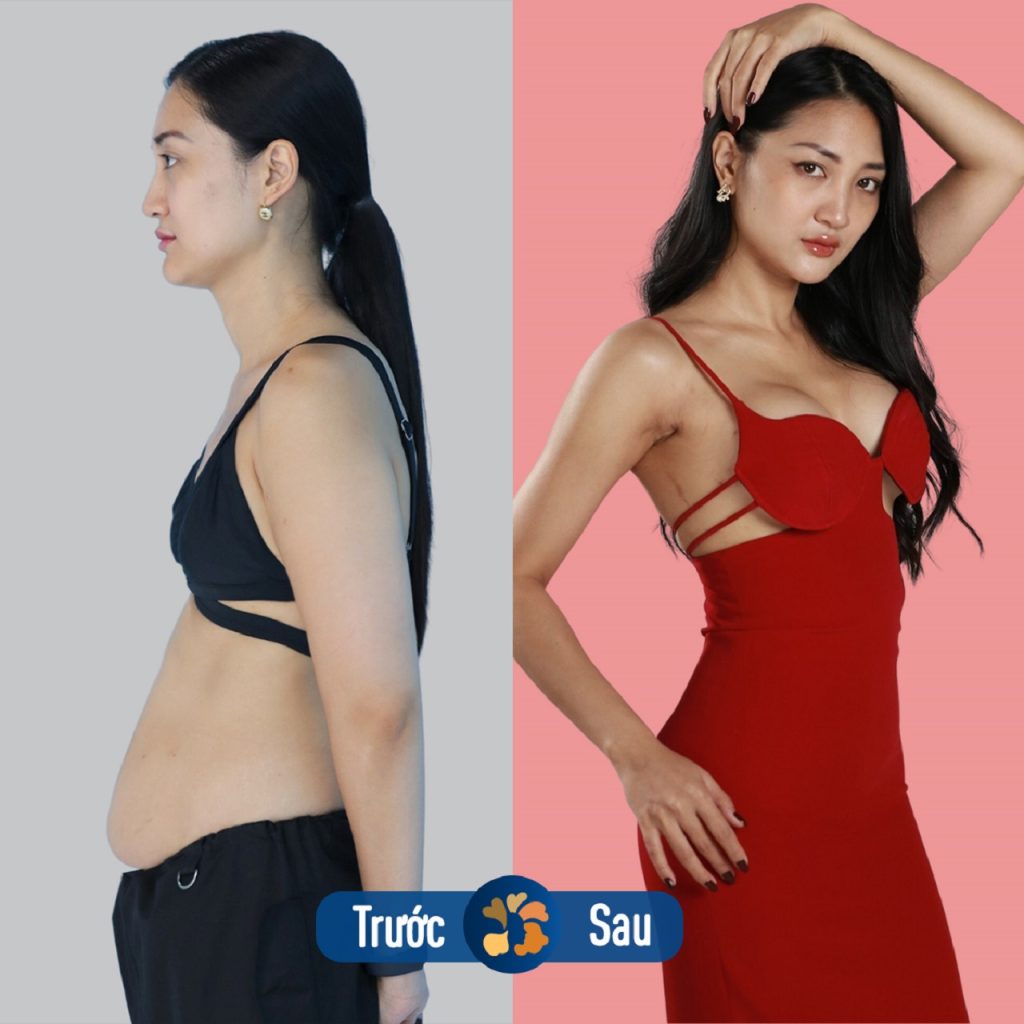 Giảm mỡ tại kiến tạo vòng eo thon gọn, vóc dáng chuẩn đẹp