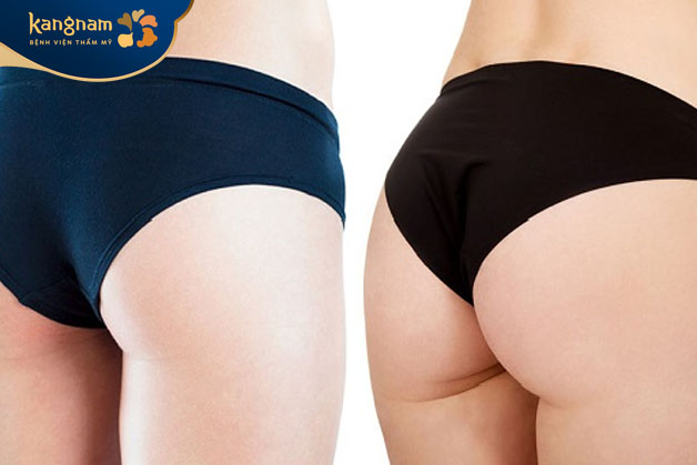 Nâng mông bằng chất liệu độn