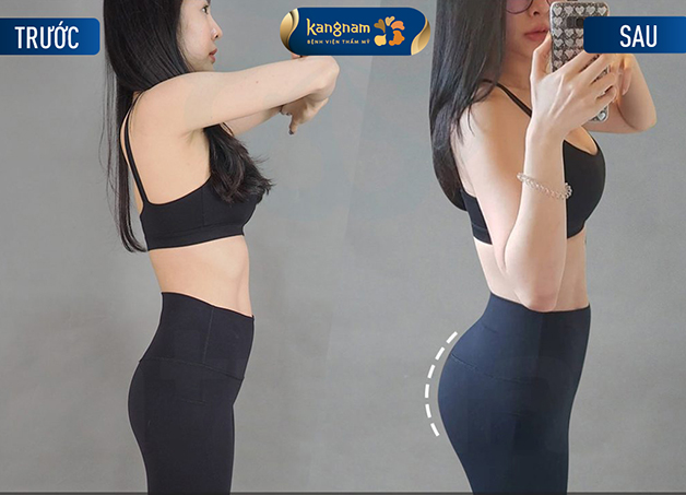 Mông cong quyến rũ, đàn hồi tự nhiên