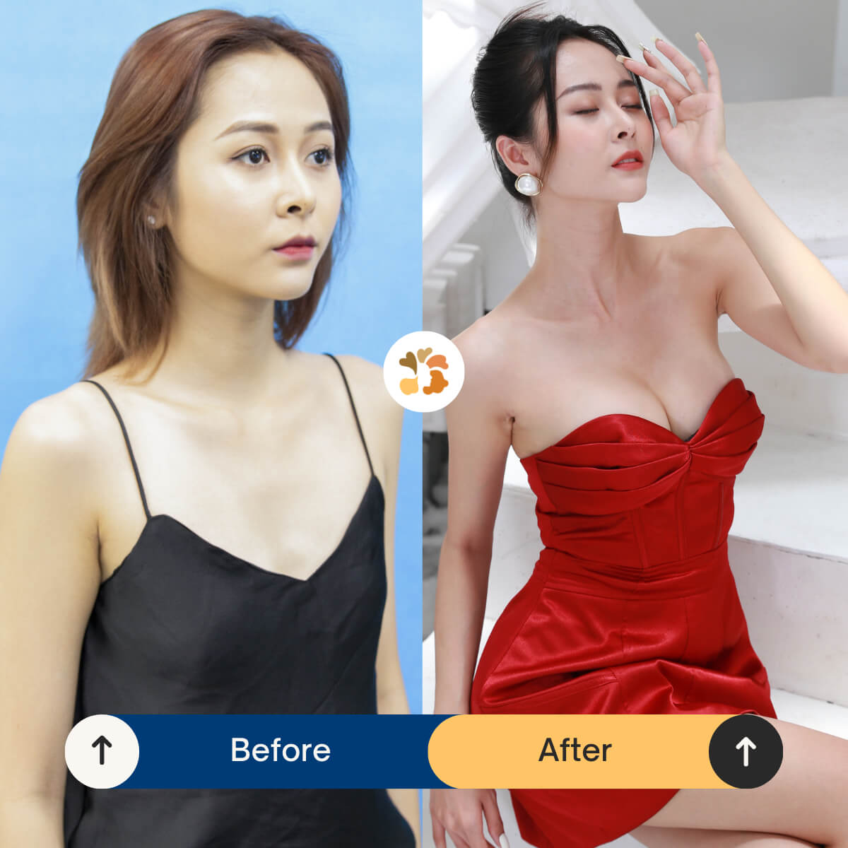 Diễn viên Bảo Tiên quyến rũ, sexy hơn sau khi nâng ngực