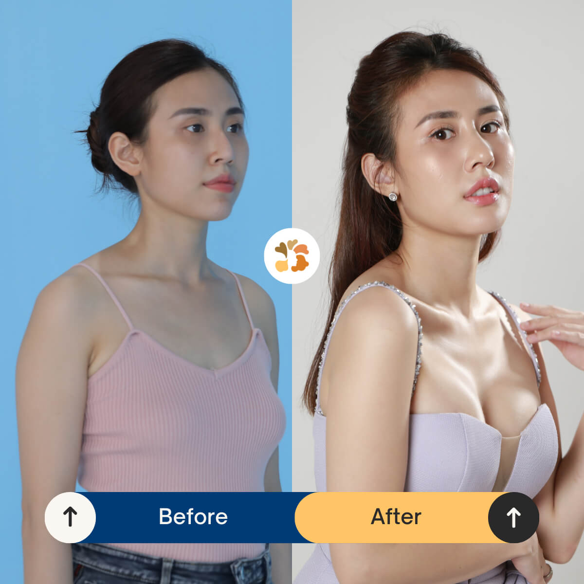 Vòng 1 căng tròn đầy đặn, giúp khách hàng tự tin khoe cá tính