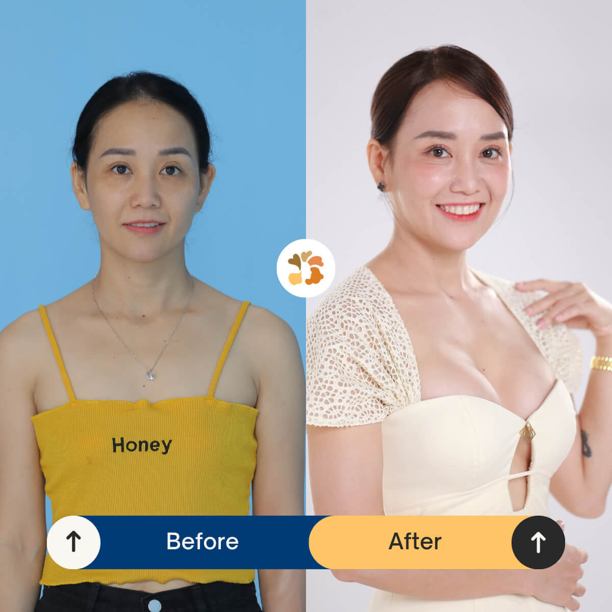 Vòng 1 căng tròn, đầy đặn và cân đối với tỷ lệ cơ thể