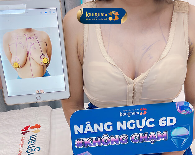 Khách hàng thực hiện thành công treo ngực sa trễ