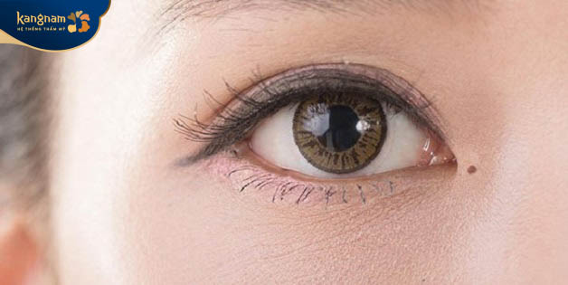 Người có nốt ruồi ở khóe mắt thường là người sống tình cảm, cuộc sống gia đình hạnh phúc