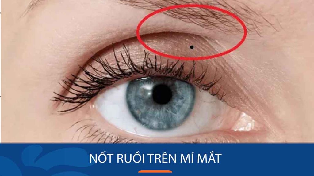 Nốt ruồi trên mí mắt: Giải mã về ý nghĩa và vận mệnh