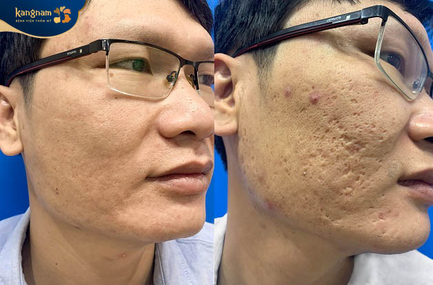 Làn da của khách hàng cải thiện rõ rệt