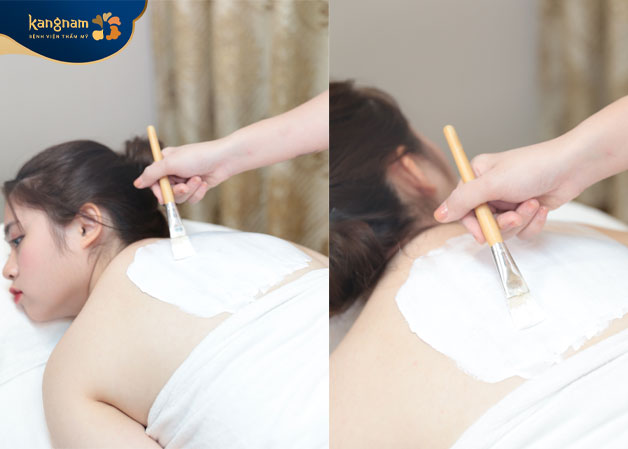 Thoa kem kích trắng