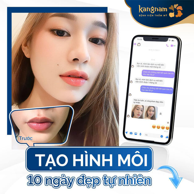 Khách hàng hài lòng sau khi tạo hình môi tim tại Kangnam