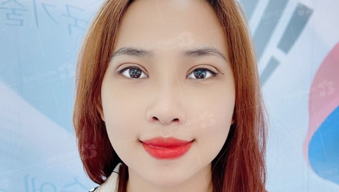 Phục hồi nhanh chóng: 5-7 ngày tự nhiên