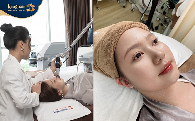 Ứng dụng công nghệ cao trong trẻ hóa da