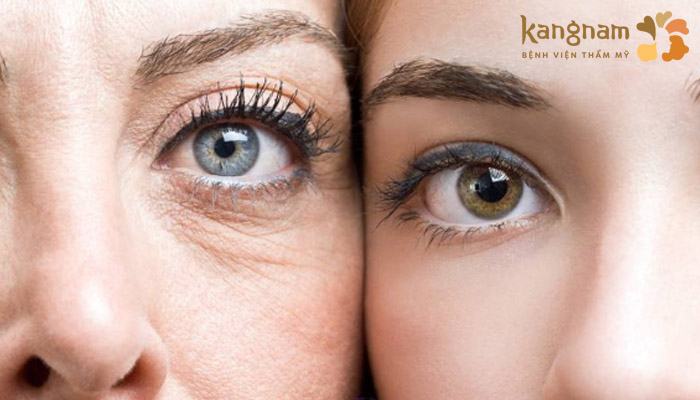 Tuổi tác là một trong những nguyên nhân chính gây lão hóa mắt