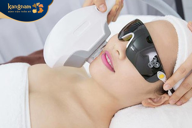 Kangnam ứng dụng công nghệ triệt lông Diode Laser hiện đại