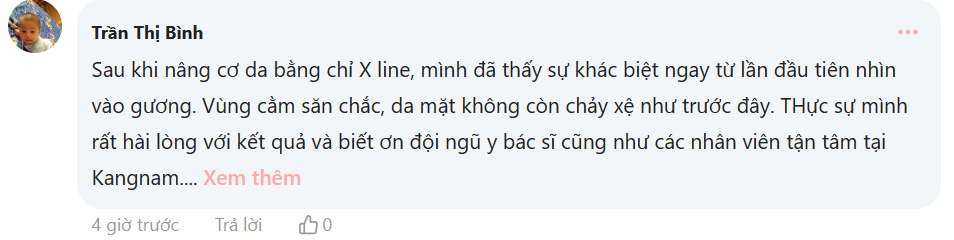 review căng da mặt Kangnam