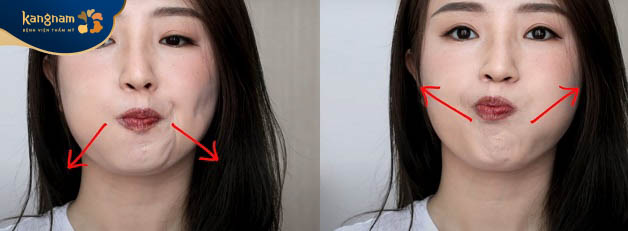 Bài tập khắc phục cằm lẹm tại nhà