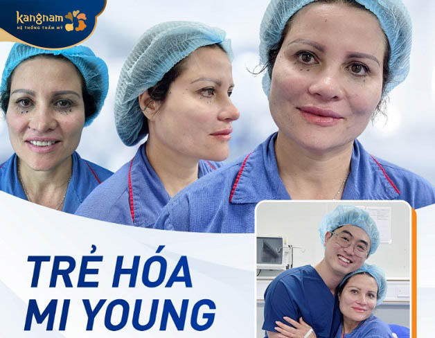 Căng da mặt bằng chỉ Mi Young là công nghệ trẻ hóa da tân tiến từ Hàn Quốc, được chuyển giao độc quyền với thương hiệu thẩm mỹ Kangnam