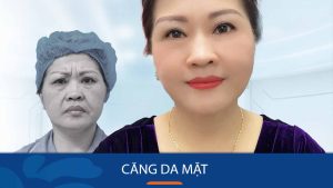 Địa chỉ căng da mặt tốt nhất tại Hải Phòng – Kangnam đảm bảo hiệu quả & an toàn