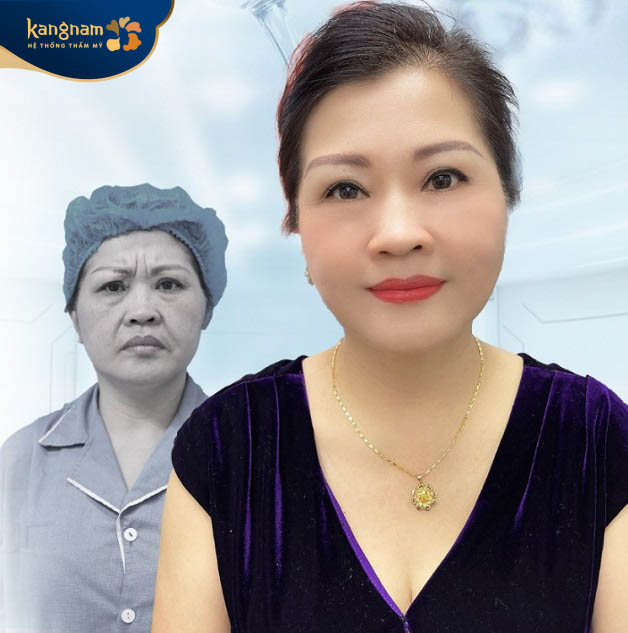 Viện thẩm mỹ Kangnam là địa chỉ căng da mặt Đà Nẵng uy tín