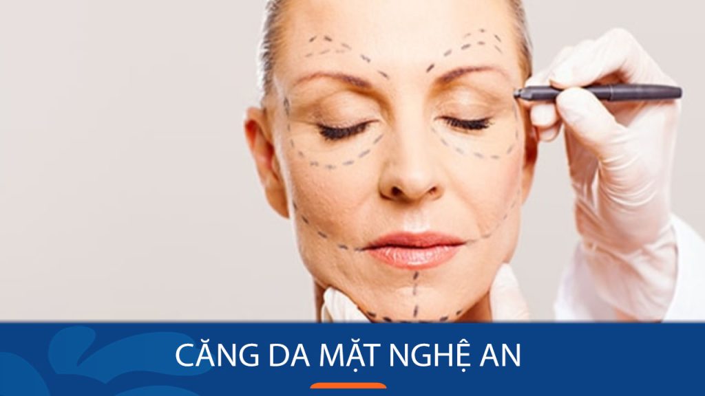 Địa chỉ căng da mặt Nghệ An được nhiều khách hàng tin tưởng