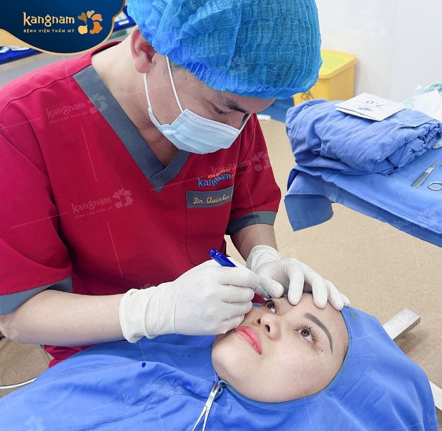 Thế kế nếp mí mắt chuẩn tỷ lệ vàng