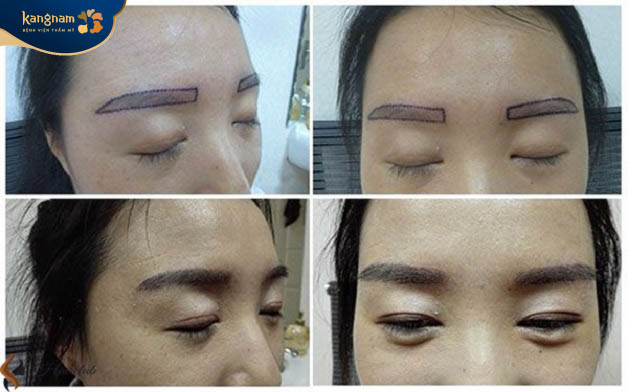 Chị Trang hài lòng với kết quả sau khi cấy chân mày