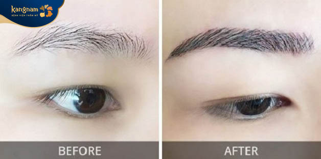 Phương pháp cấy lông mày là kỹ thuật tiên tiến, hiện đại