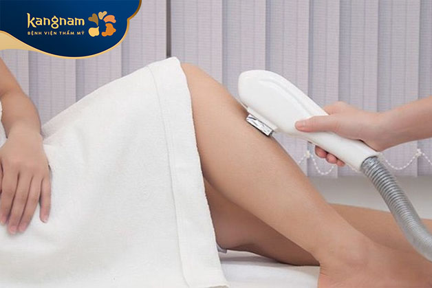 Viện thẩm mỹ Kangnam là địa chỉ triệt lông chân hiệu quả tại Bình Dương