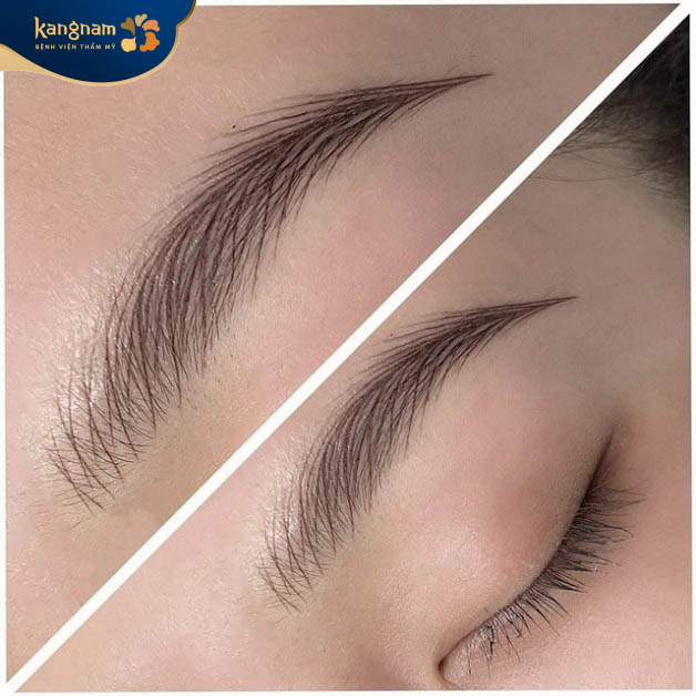 Điêu khắc lông mày khắc phục mọi khuyết điểm