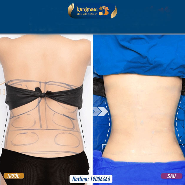 Tự tin với vóc dáng mới nhỏ nhắn, không có mỡ thừa