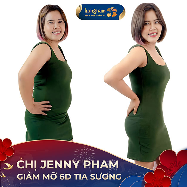 Giảm mỡ vùng mông và các phân vùng khác trên cơ thể