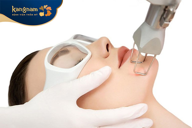 Điều trị sẹo lồi bằng Laser Co2