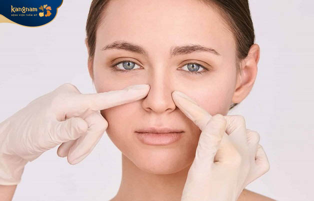 Không nên massage sau khi tiêm filler mũi