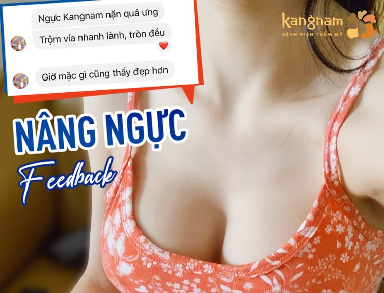 “Ngực Kangnam nặn quá ưng, trộm vía nhanh lành, tròn đều. Giờ mặc gì cũng đẹp”. Chị K. N chia sẻ.