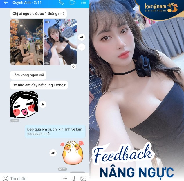 Bạn Quỳnh Anh feedback “Chị ơi ngực em được 1 tháng rồi nè, làm xong ngon quá”.