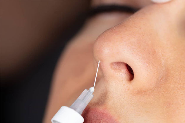 Tốc độ mũi hồi phục & vào form nhanh