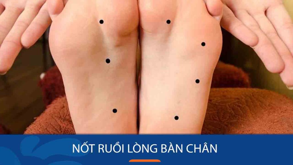 Nốt ruồi ở lòng bàn chân: Bí ẩn ý nghĩa và ảnh hưởng đến vận mệnh, tài lộc, sức khỏe