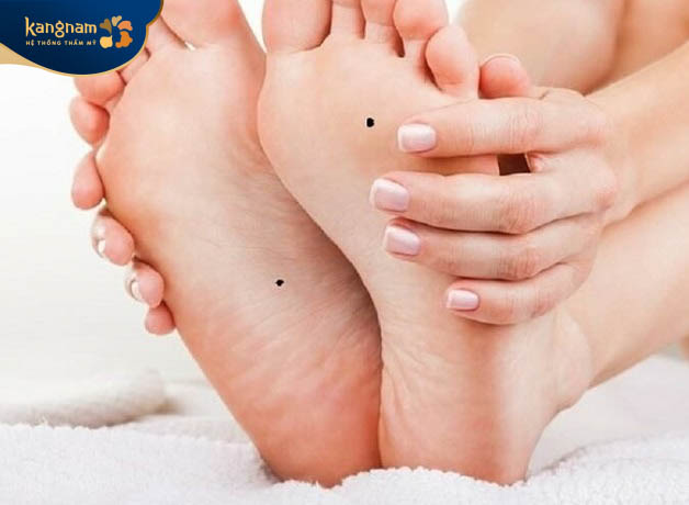 Người có nốt ruồi ở bàn chân to gặp được nhiều may mắn, phú quý