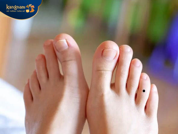 Người sở hữu nốt ruồi ở ngón áp út có tính cách phóng khoáng, vô tư