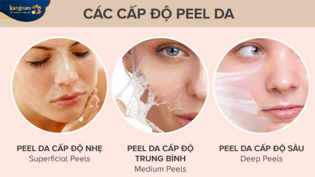 Các cấp độ của peel da