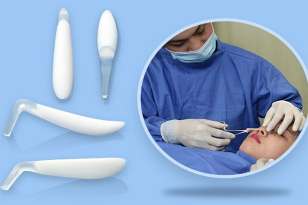 Sử dụng sụn nhân tạo để nâng mũi