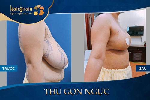 Bầu ngực cân đối và hài hòa với vóc dáng cơ thể