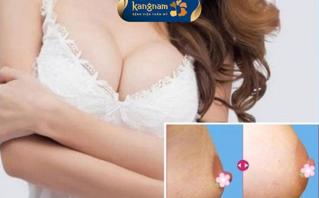 Thu nhỏ đầu ti an toàn, hiệu quả, tính thẩm mỹ cao tại Kangnam