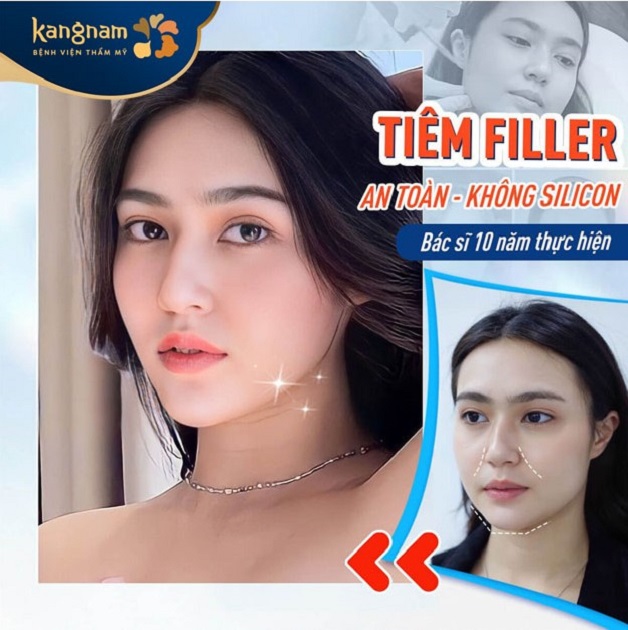 Tiêm filler đảm bảo an toàn, không gây đau đớn