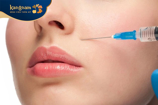 Thông thường nên kiêng cữ một số hoạt động trong khoảng 1 đến 2 tuần sau khi tiêm filler